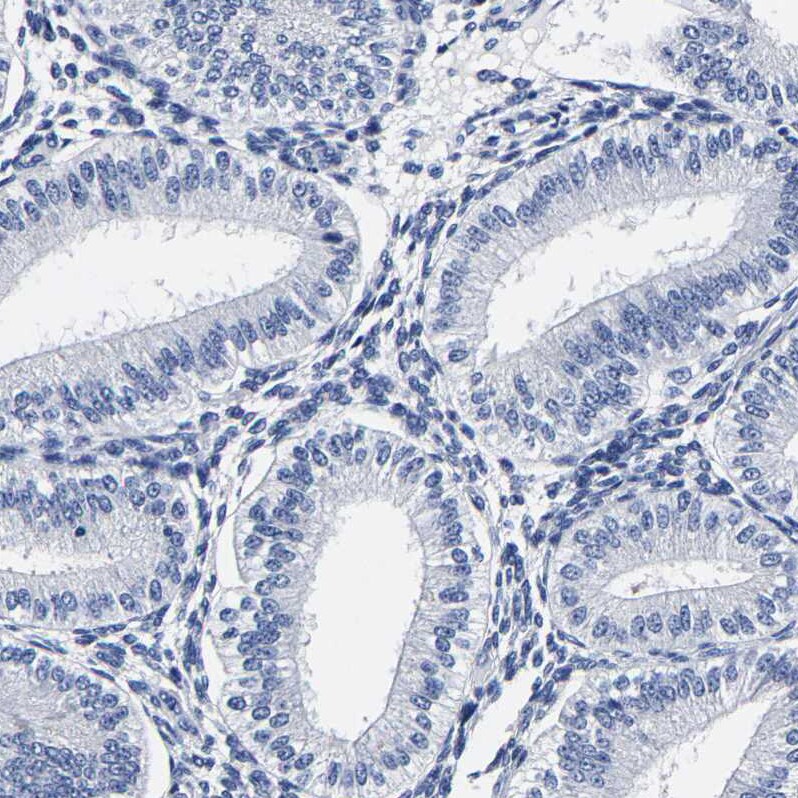 AKAP4 Antibody - BSA Free Immunohistochemistry-Paraffin: AKAP4 Antibody [NBP1-89164]