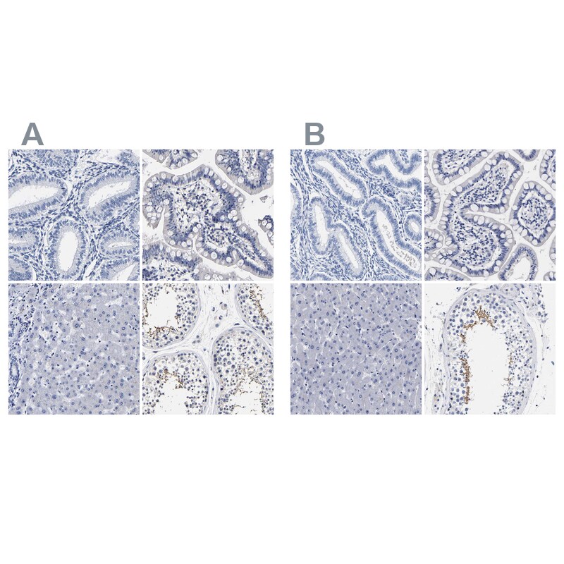 AKAP4 Antibody - BSA Free Immunohistochemistry-Paraffin: AKAP4 Antibody [NBP1-89164]