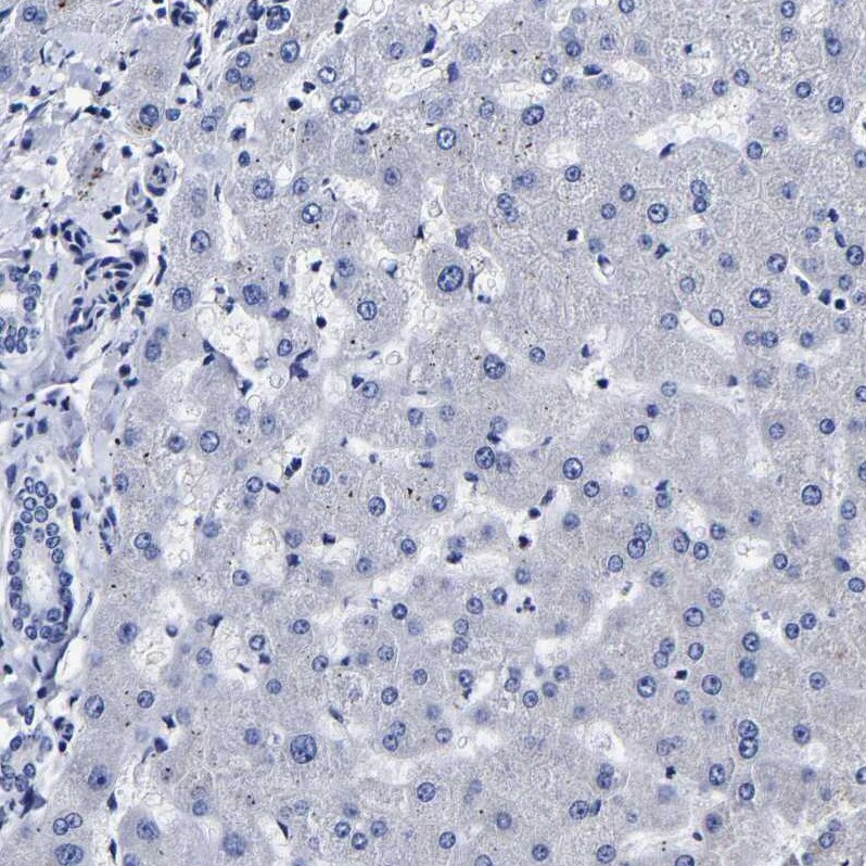 AKAP4 Antibody - BSA Free Immunohistochemistry-Paraffin: AKAP4 Antibody [NBP1-89164]
