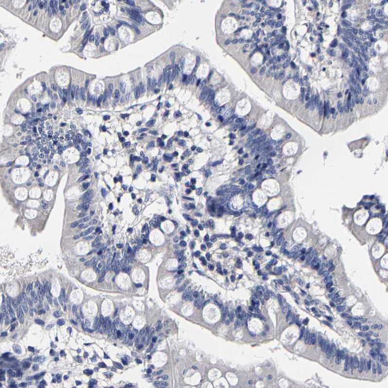 AKAP4 Antibody - BSA Free Immunohistochemistry-Paraffin: AKAP4 Antibody [NBP1-89164]