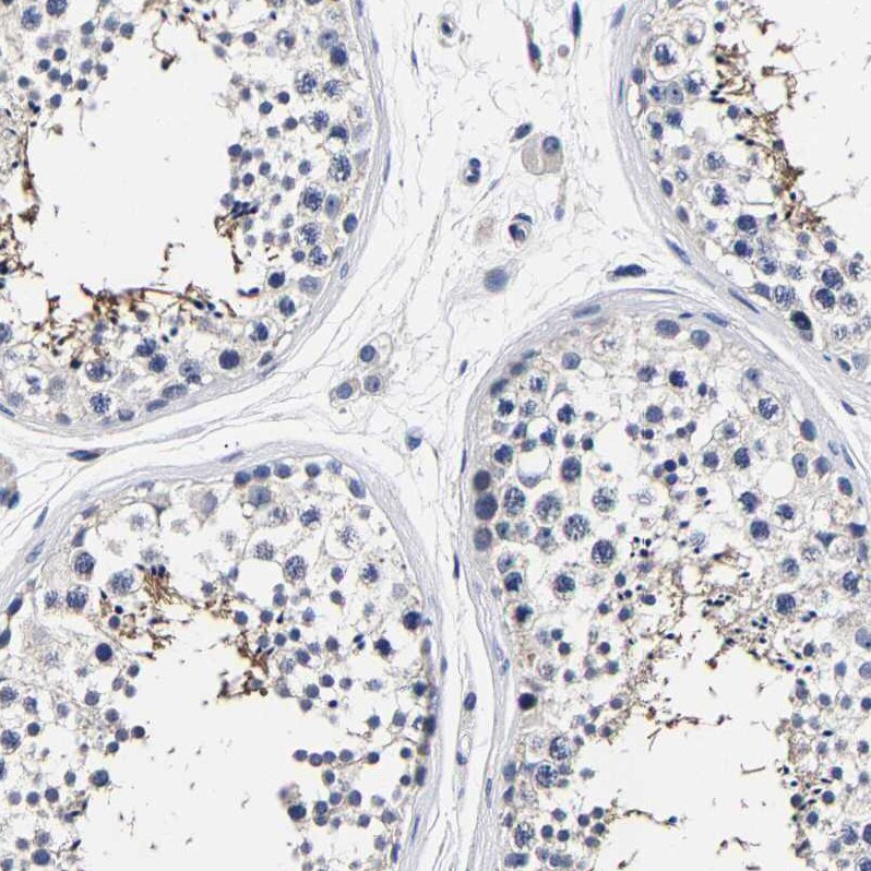 AKAP4 Antibody - BSA Free Immunohistochemistry-Paraffin: AKAP4 Antibody [NBP1-89164]