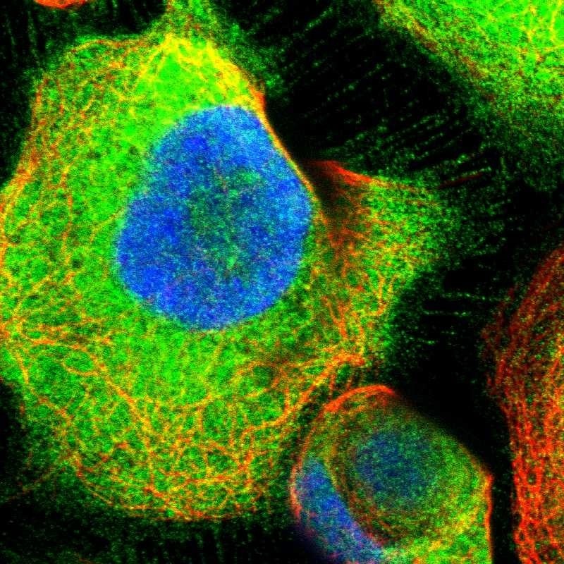 ATIC Antibody - BSA Free Immunocytochemistry/ Immunofluorescence: ATIC Antibody [NBP1-89192]