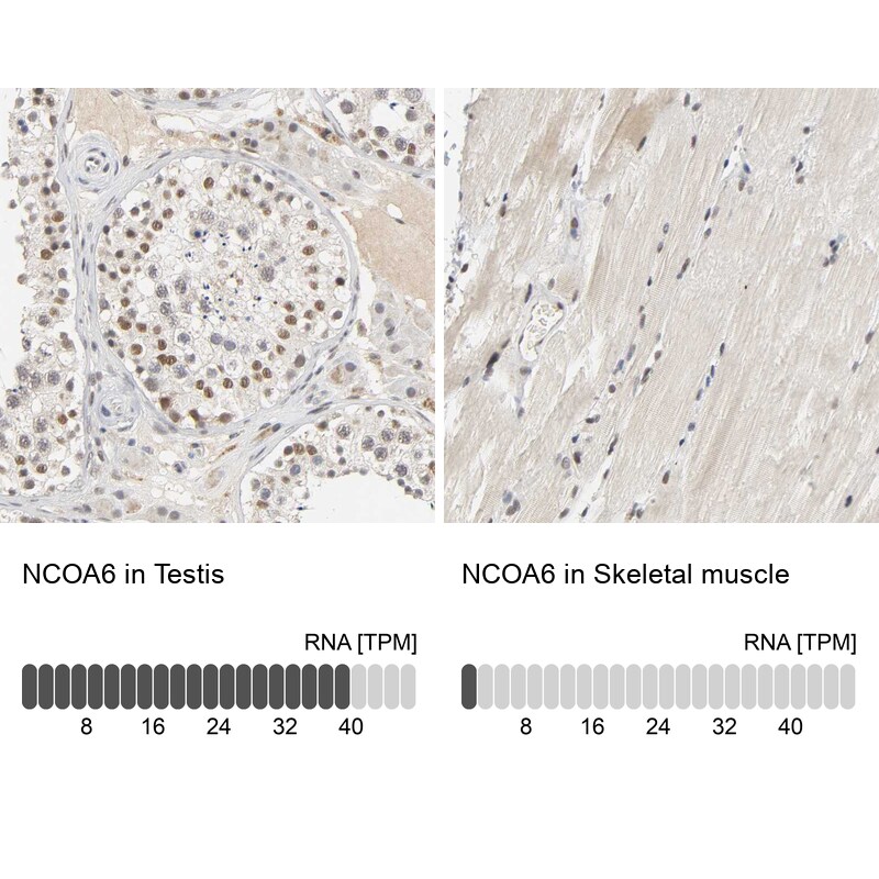 NCOA6 Antibody - BSA Free Immunohistochemistry-Paraffin: NCOA6 Antibody [NBP1-89193]
