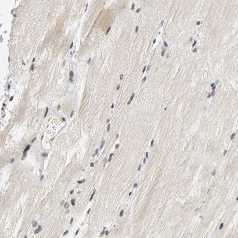 NCOA6 Antibody - BSA Free Immunohistochemistry-Paraffin: NCOA6 Antibody [NBP1-89193]