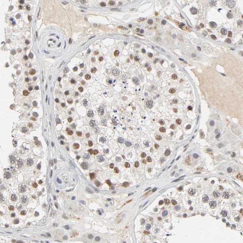 NCOA6 Antibody - BSA Free Immunohistochemistry-Paraffin: NCOA6 Antibody [NBP1-89193]