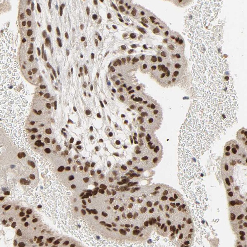 NCOA6 Antibody - BSA Free Immunohistochemistry-Paraffin: NCOA6 Antibody [NBP1-89193]
