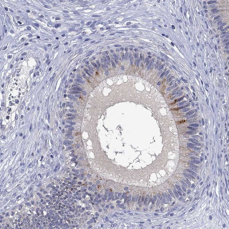AgRP/ART Antibody - BSA Free Immunohistochemistry-Paraffin: AgRP/ART Antibody [NBP1-89203]