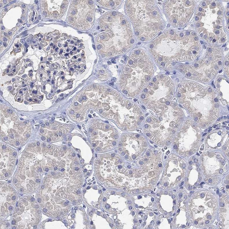 AgRP/ART Antibody - BSA Free Immunohistochemistry-Paraffin: AgRP/ART Antibody [NBP1-89203]