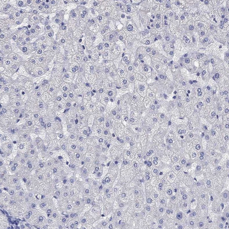 AgRP/ART Antibody - BSA Free Immunohistochemistry-Paraffin: AgRP/ART Antibody [NBP1-89203]