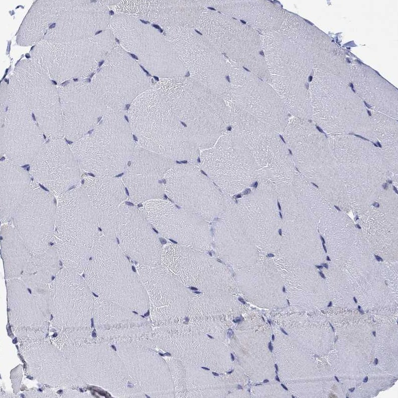 AgRP/ART Antibody - BSA Free Immunohistochemistry-Paraffin: AgRP/ART Antibody [NBP1-89203]