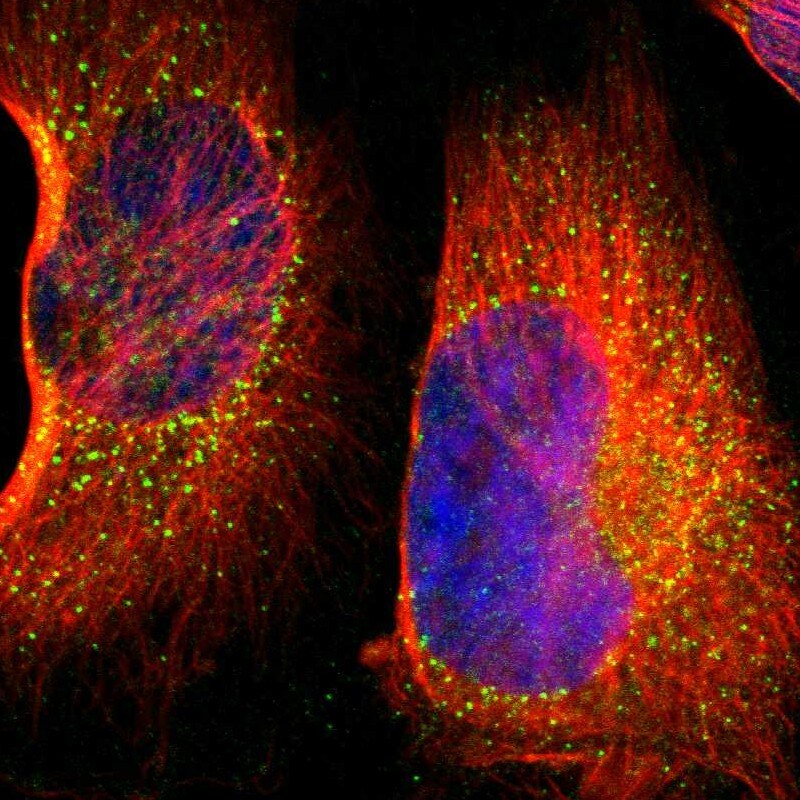 BTK Antibody - BSA Free Immunocytochemistry/ Immunofluorescence: BTK Antibody [NBP1-89207]