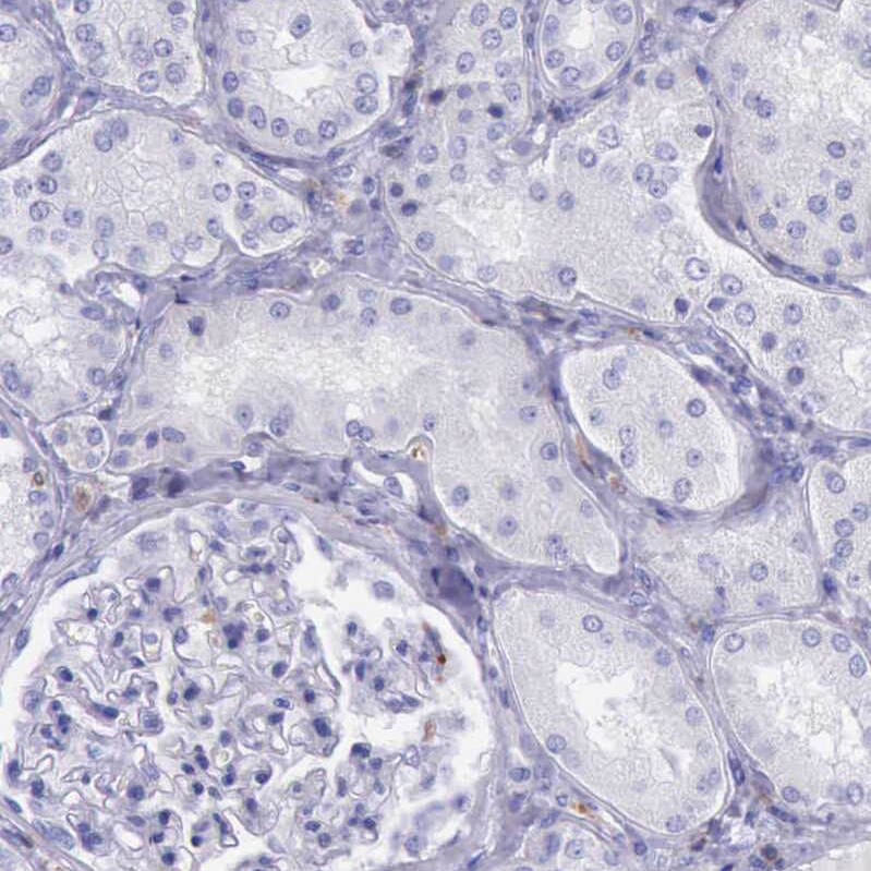 BTK Antibody - BSA Free Immunohistochemistry-Paraffin: BTK Antibody [NBP1-89207]
