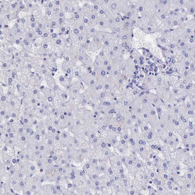 BTK Antibody - BSA Free Immunohistochemistry-Paraffin: BTK Antibody [NBP1-89207]
