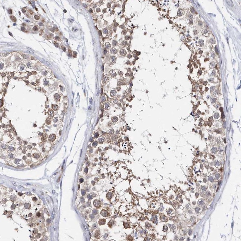 SPATA5 Antibody - BSA Free Immunohistochemistry-Paraffin: SPATA5 Antibody [NBP1-89214]
