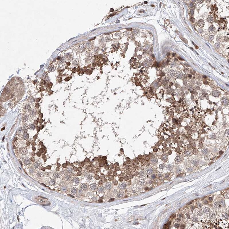 LACE1 Antibody - BSA Free Immunohistochemistry-Paraffin: LACE1 Antibody [NBP1-89216]