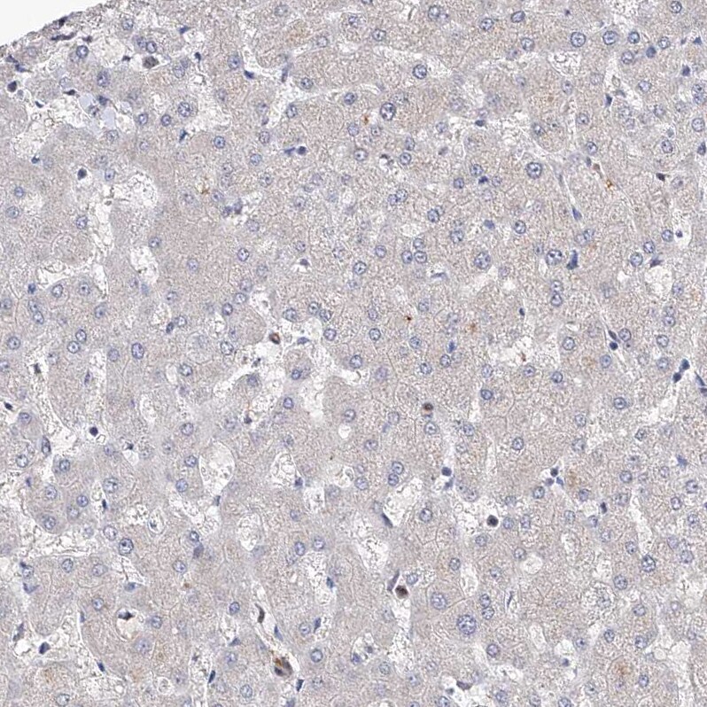 LACE1 Antibody - BSA Free Immunohistochemistry-Paraffin: LACE1 Antibody [NBP1-89216]