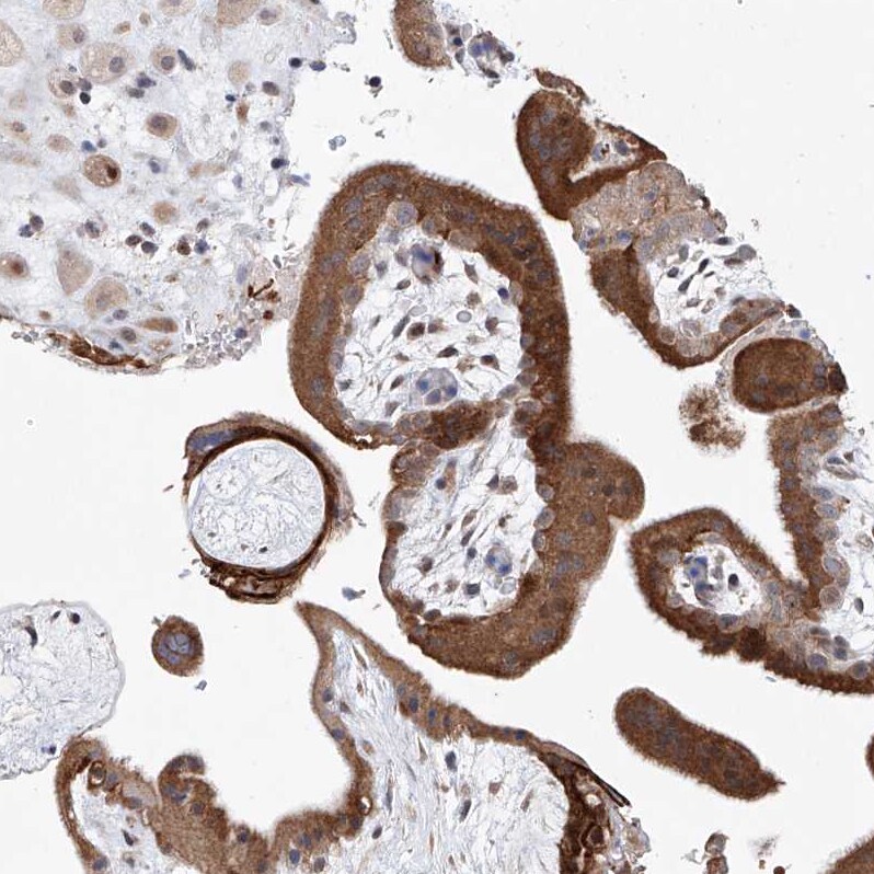 LACE1 Antibody - BSA Free Immunohistochemistry-Paraffin: LACE1 Antibody [NBP1-89216]