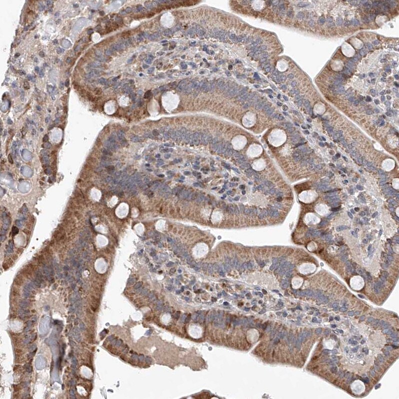 LACE1 Antibody - BSA Free Immunohistochemistry-Paraffin: LACE1 Antibody [NBP1-89216]