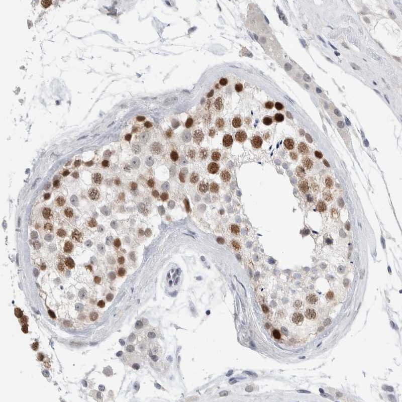 CASC5 Antibody - BSA Free Immunohistochemistry: CASC5 Antibody - BSA Free [NBP1-89223]