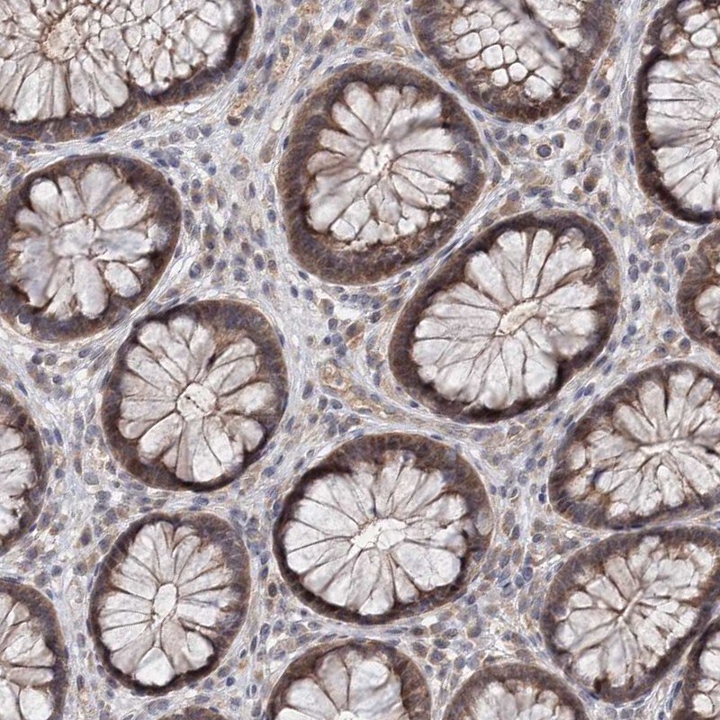 AP3B1 Antibody - BSA Free Immunohistochemistry-Paraffin: AP3B1 Antibody [NBP1-89228]