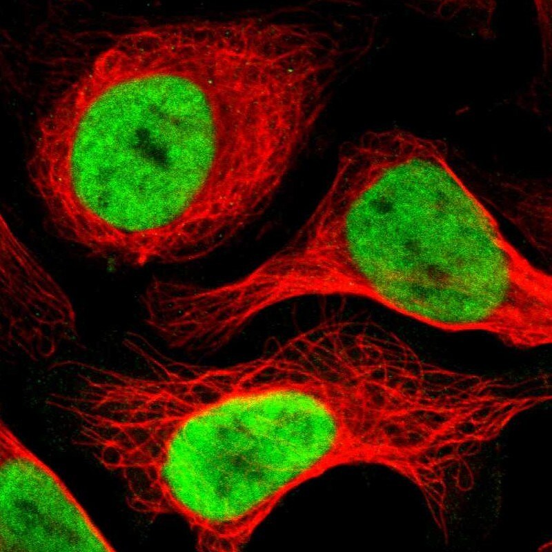 ADNP Antibody - BSA Free Immunocytochemistry/ Immunofluorescence: ADNP Antibody [NBP1-89236]