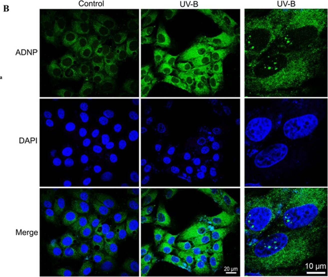 ADNP Antibody - BSA Free