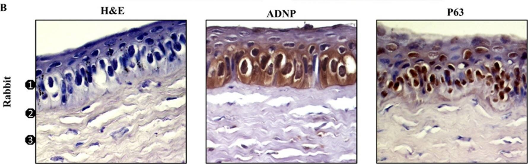 ADNP Antibody - BSA Free