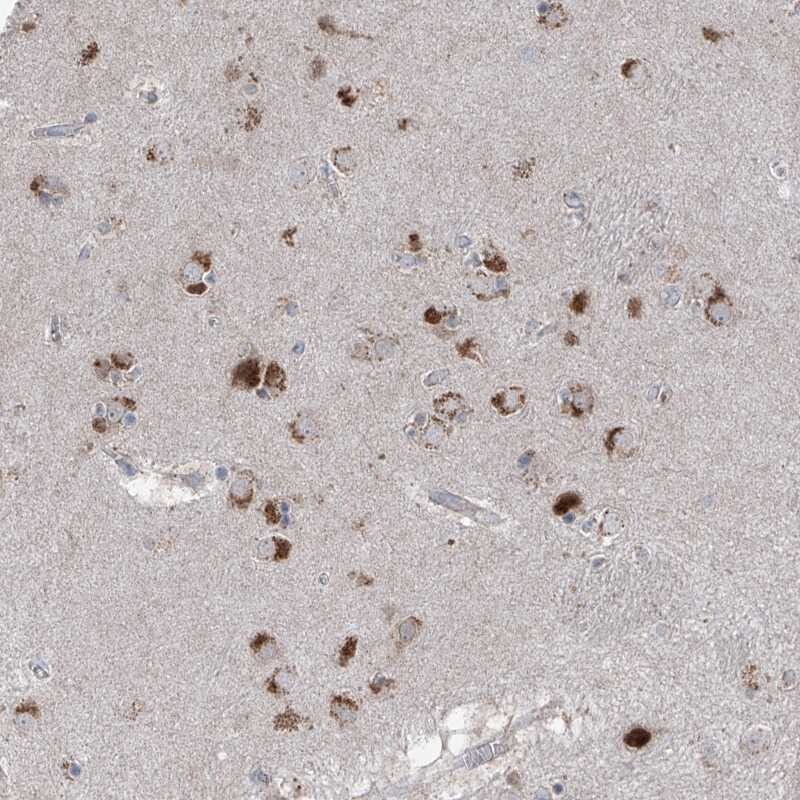 AGPS Antibody - BSA Free Immunohistochemistry-Paraffin: AGPS Antibody [NBP1-89240]