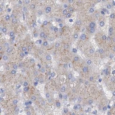 ACY3 Antibody - BSA Free Immunohistochemistry-Paraffin: ACY3 Antibody [NBP1-89256]