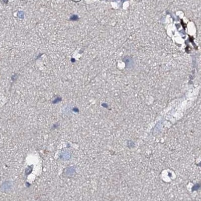 ACY3 Antibody - BSA Free Immunohistochemistry-Paraffin: ACY3 Antibody [NBP1-89256]