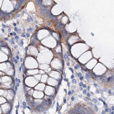 ACY3 Antibody - BSA Free Immunohistochemistry-Paraffin: ACY3 Antibody [NBP1-89256]