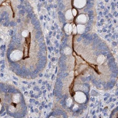 ACY3 Antibody - BSA Free Immunohistochemistry-Paraffin: ACY3 Antibody [NBP1-89256]