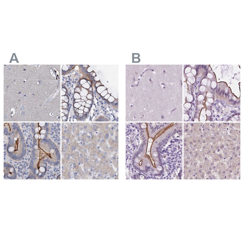 ACY3 Antibody - BSA Free Immunohistochemistry-Paraffin: ACY3 Antibody [NBP1-89256]