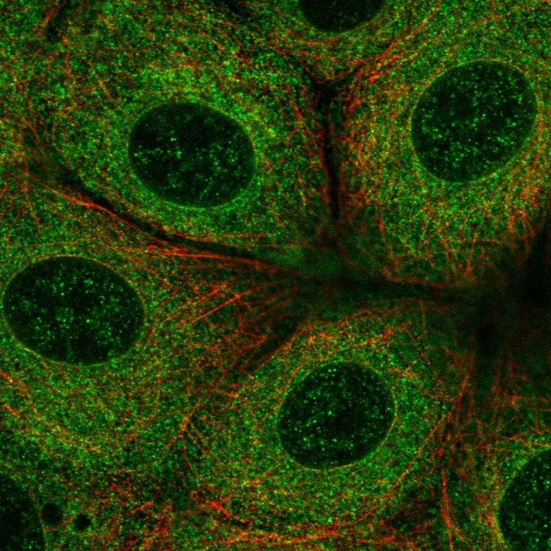 FATP3/SLC27A3 Antibody - BSA Free Immunocytochemistry/ Immunofluorescence: FATP3/SLC27A3 Antibody [NBP1-89265]