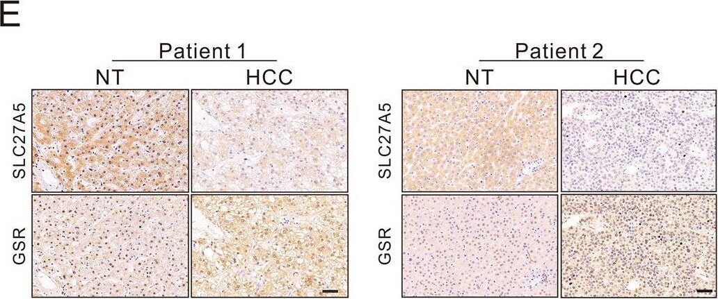 FATP5/SLC27A5 Antibody - BSA Free