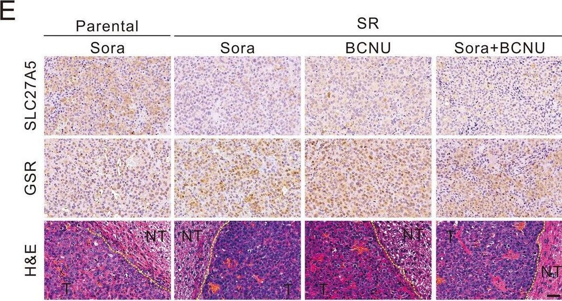 FATP5/SLC27A5 Antibody - BSA Free