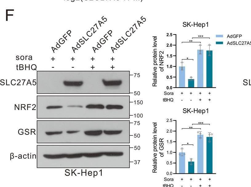 FATP5/SLC27A5 Antibody - BSA Free