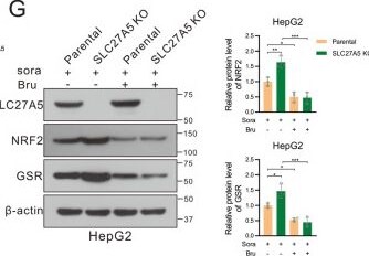 FATP5/SLC27A5 Antibody - BSA Free