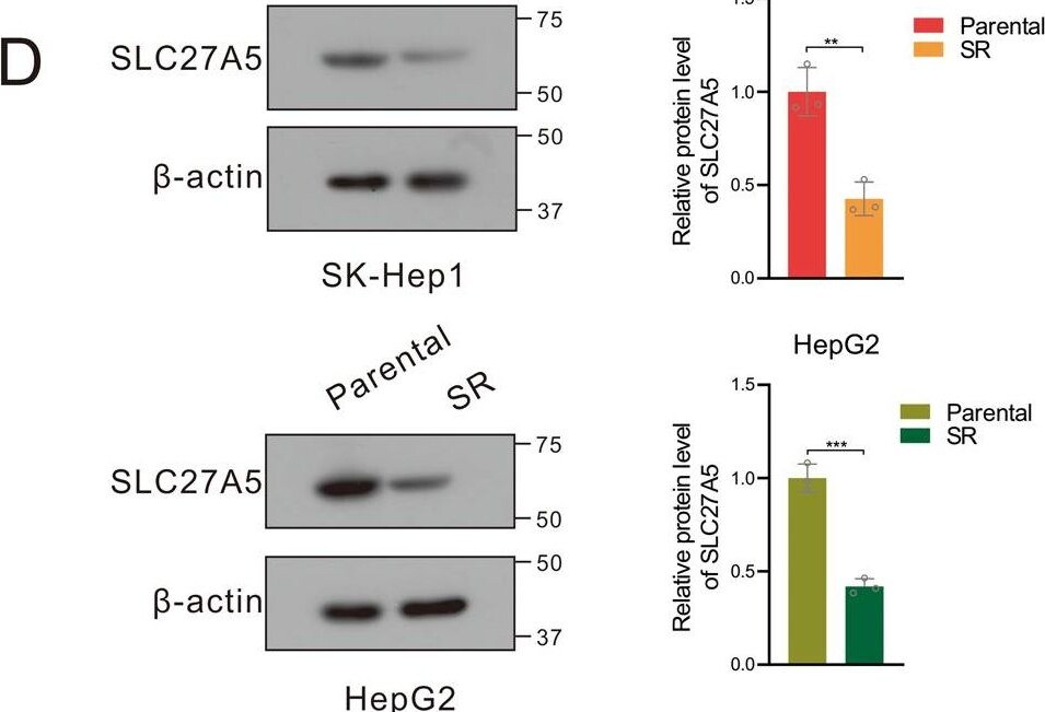 FATP5/SLC27A5 Antibody - BSA Free