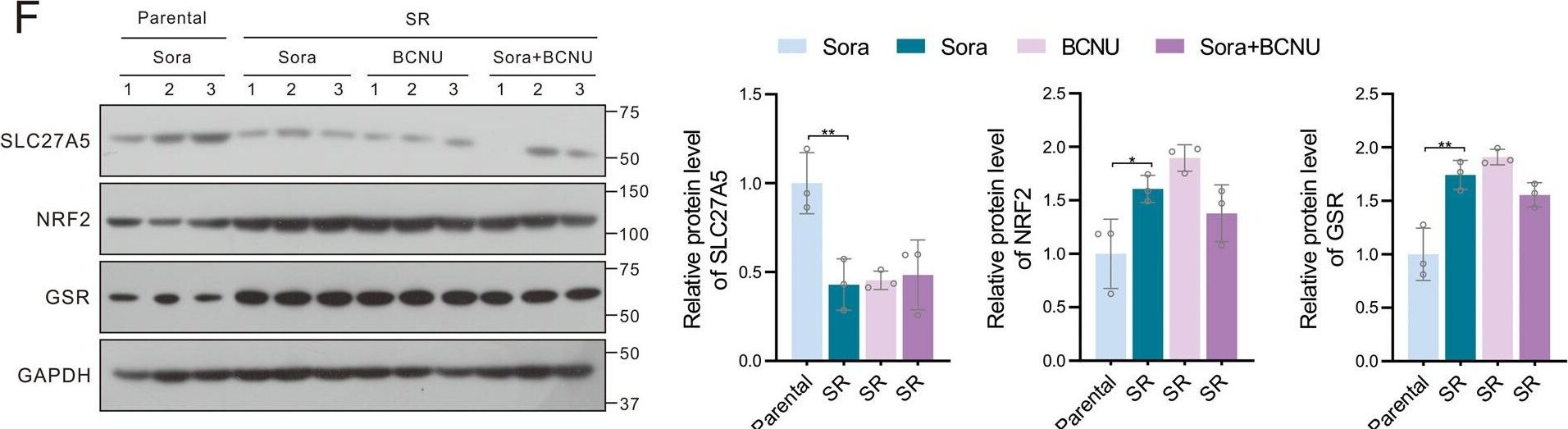 FATP5/SLC27A5 Antibody - BSA Free