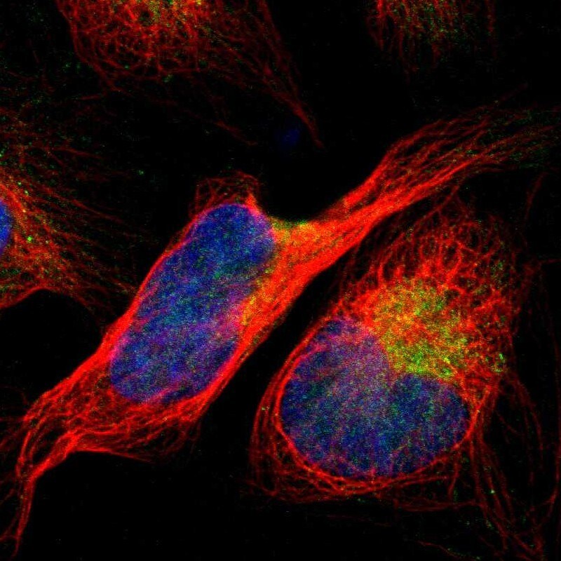 ACSL1 Antibody - BSA Free Immunocytochemistry/ Immunofluorescence: ACSL1 Antibody [NBP1-89270]