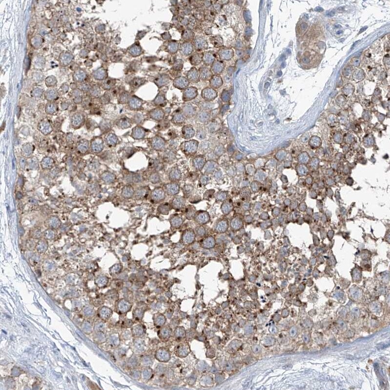 KCC3/SLC12A6 Antibody - BSA Free Immunohistochemistry-Paraffin: KCC3/SLC12A6 Antibody [NBP1-89282]