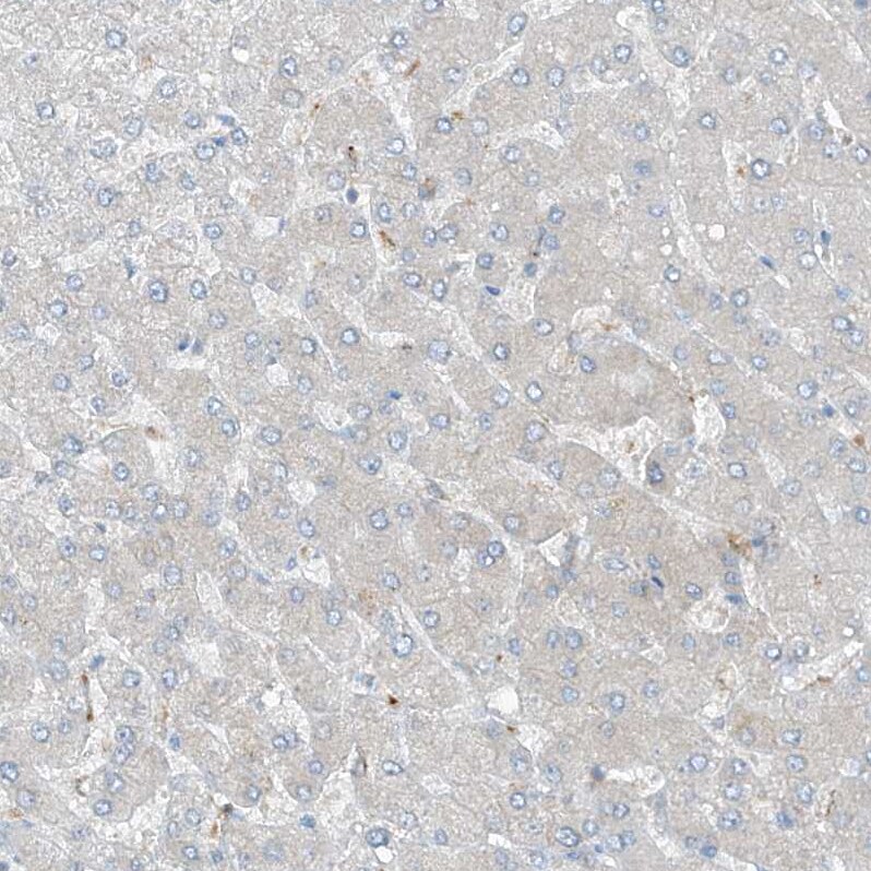 KCC3/SLC12A6 Antibody - BSA Free Immunohistochemistry-Paraffin: KCC3/SLC12A6 Antibody [NBP1-89282]