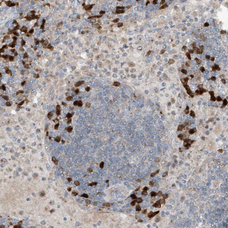 KCC3/SLC12A6 Antibody - BSA Free Immunohistochemistry-Paraffin: KCC3/SLC12A6 Antibody [NBP1-89282]