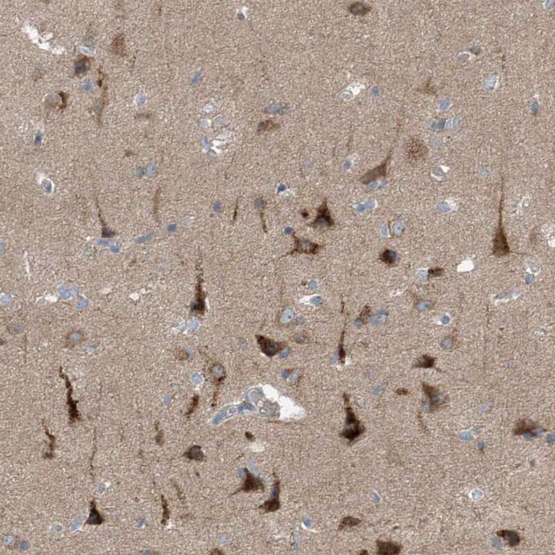 KCC3/SLC12A6 Antibody - BSA Free Immunohistochemistry-Paraffin: KCC3/SLC12A6 Antibody [NBP1-89282]
