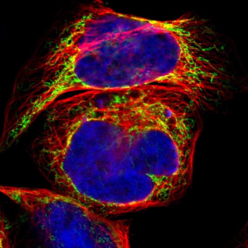 ACAT1 Antibody - BSA Free Immunocytochemistry/ Immunofluorescence: ACAT1 Antibody [NBP1-89285]