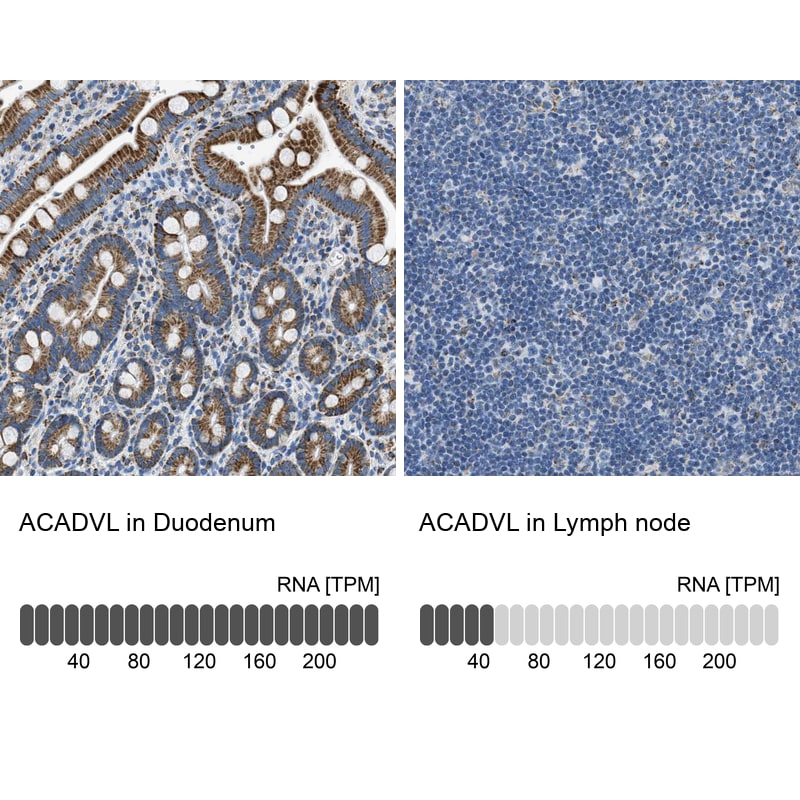 ACADVL Antibody - BSA Free Immunohistochemistry-Paraffin: ACADVL Antibody [NBP1-89287]