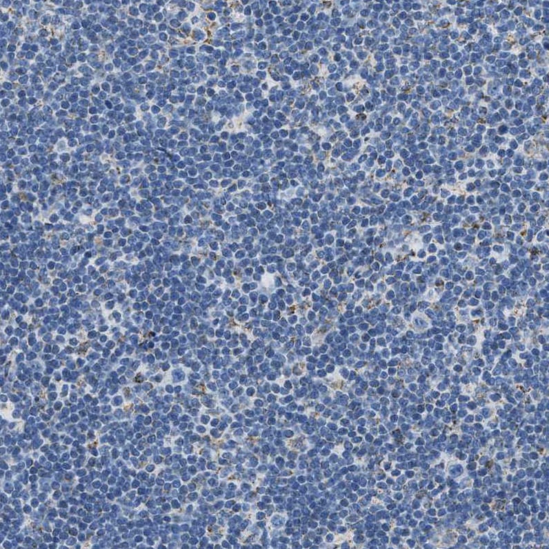 ACADVL Antibody - BSA Free Immunohistochemistry-Paraffin: ACADVL Antibody [NBP1-89287]