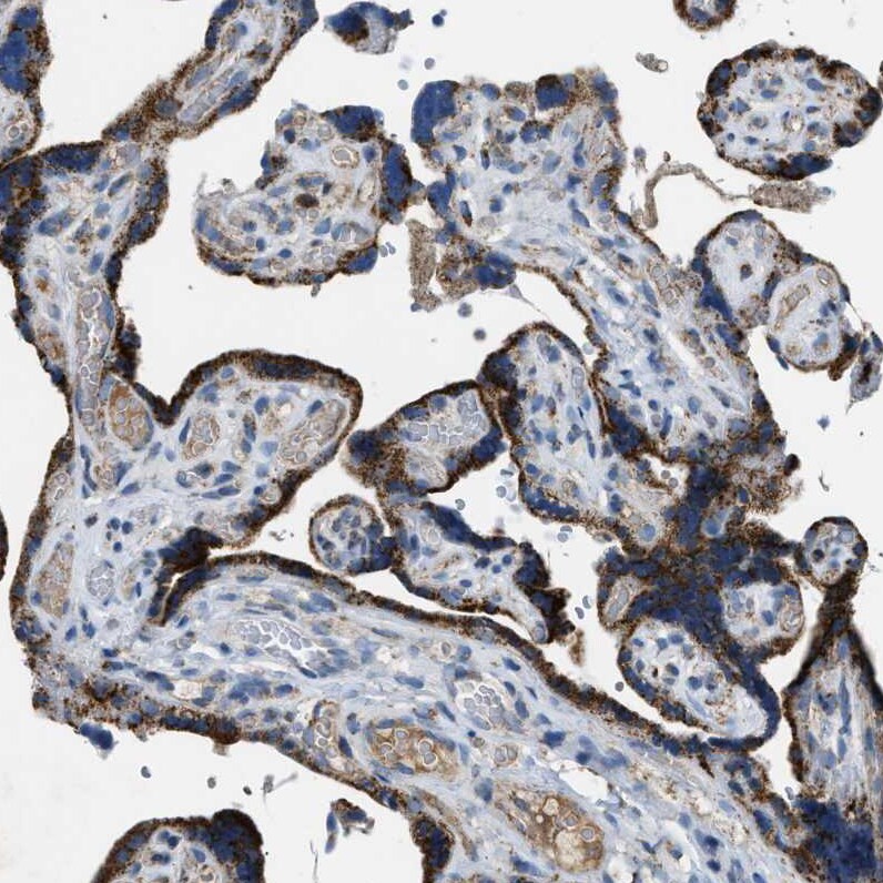 ACADVL Antibody - BSA Free Immunohistochemistry-Paraffin: ACADVL Antibody [NBP1-89287]