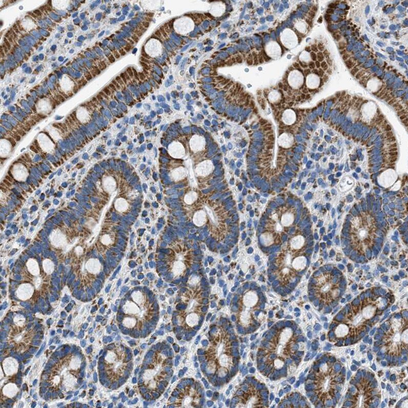ACADVL Antibody - BSA Free Immunohistochemistry-Paraffin: ACADVL Antibody [NBP1-89287]